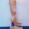 أطراف صناعية مخصصة للتشوهات الخلقية - تصميم مبتكر ووظائف متقدمة