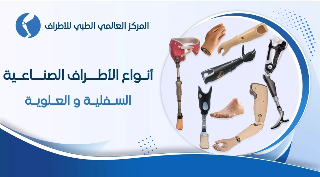 انواع الأطراف الصناعية العلوية والسفلية واسعار في مصر لسنة 2026