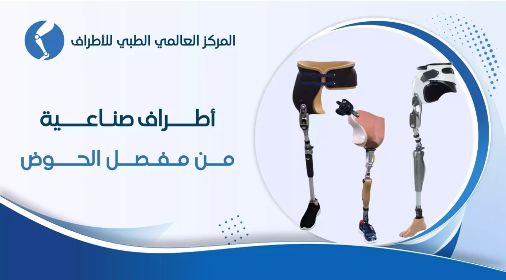 أطراف صناعية من مفصل الحوض الأنواع والاسعار