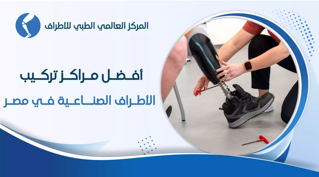 أفضل مركز الأطراف الصناعية في مصر