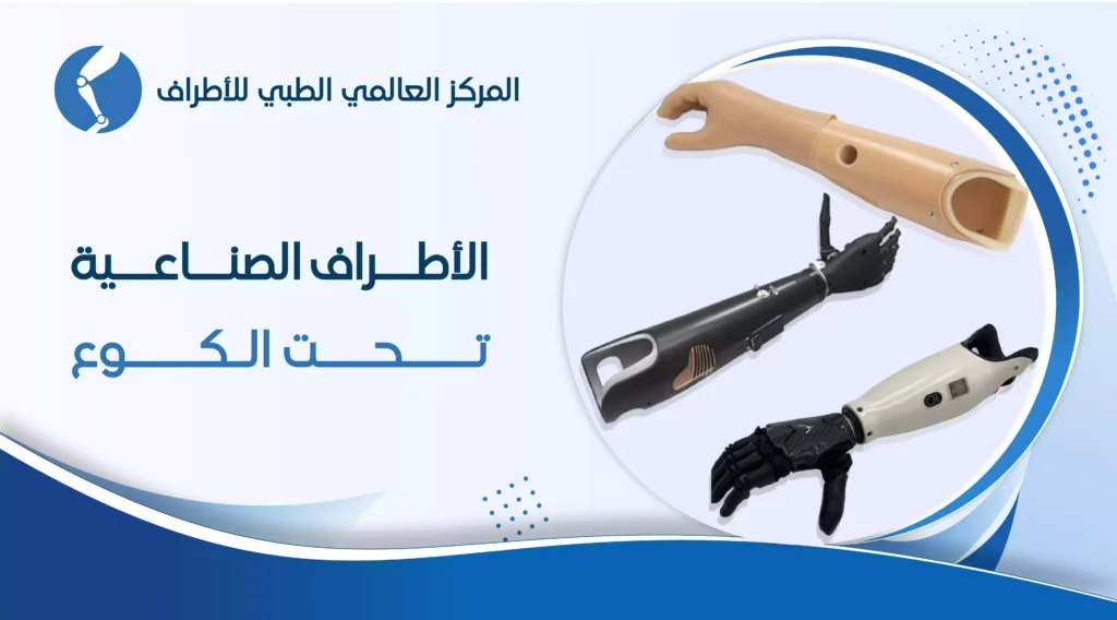 طرف صناعى تحت الكوع بافضل الاسعار في مصر 2025