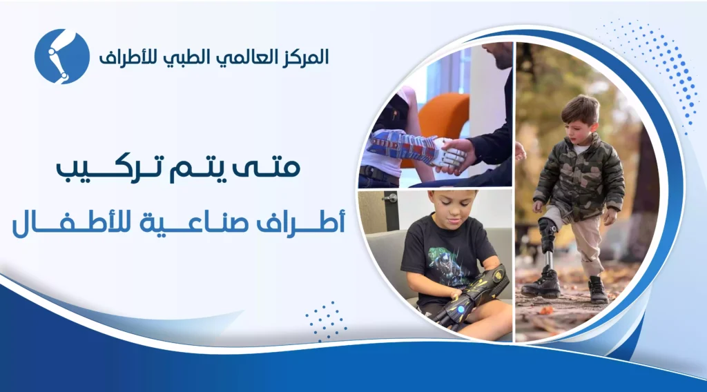 الاطراف الصناعية للأطفال: السن المناسب وعوامل تحديد القرار