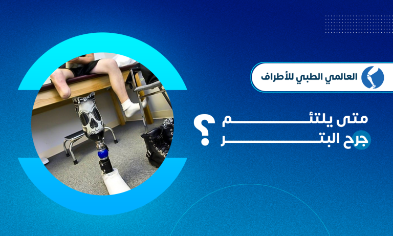 متى يلتئم جرح البتر