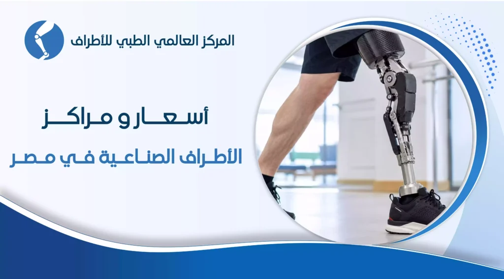 أسعار ومراكز الأطراف الصناعية في مصر