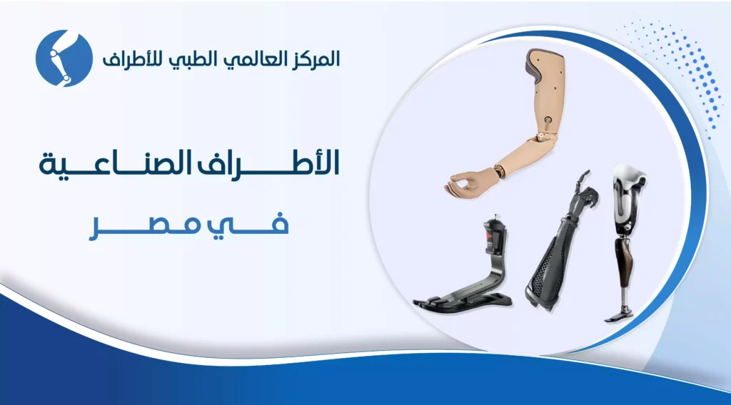 الأطراف الصناعية في مصر