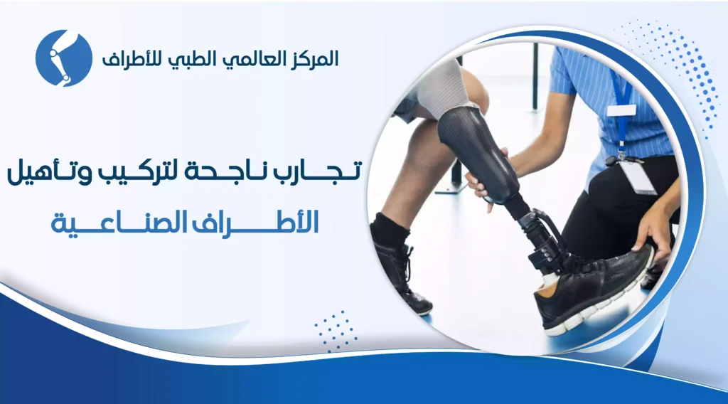 تجربة مستخدمي الأطراف الصناعية في مصر | الرحلة والتأهيل والدعم 2026