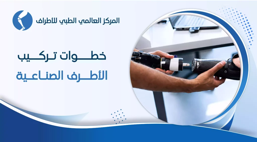 خطوات تركيب الأطراف الصناعية 4 خطوات تركيب الأطراف الصناعية
