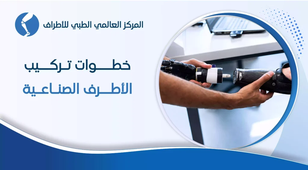 خطوات تركيب الأطراف الصناعية