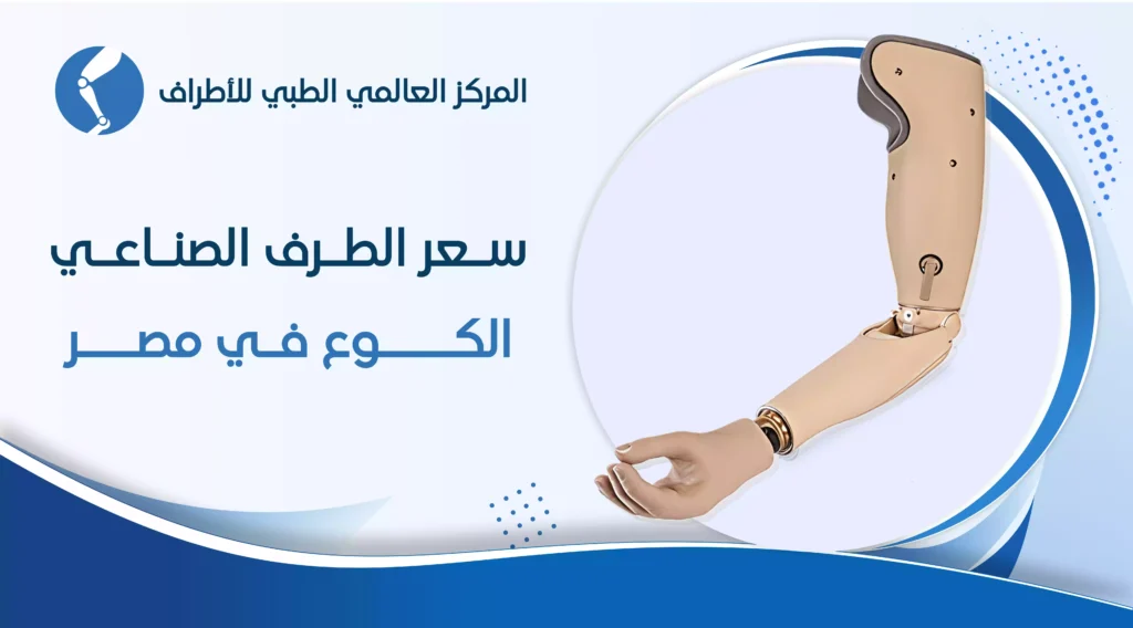 سعر الطرف الصناعي الكوع في مصر 2 سعر الطرف الصناعي الكوع في مصر