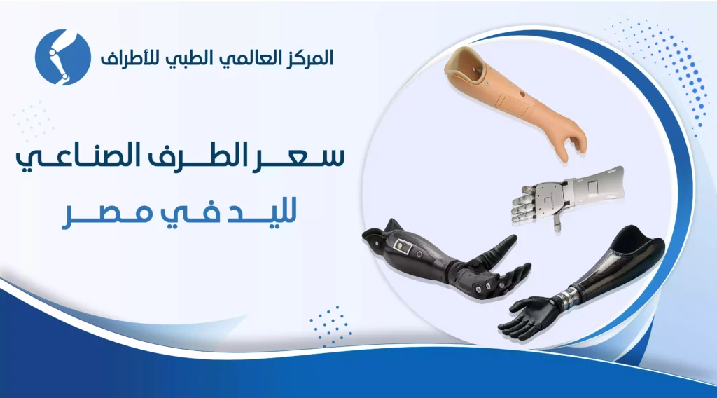 سعر الطرف الصناعي لليد في مصر
