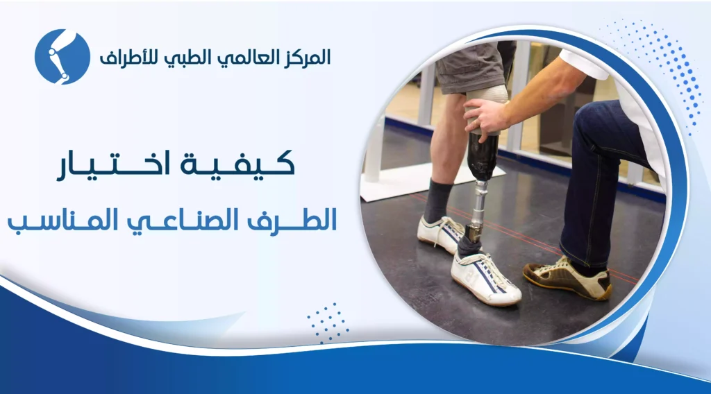 كيفية اختيار الطرف الصناعي المناسب 6 كيفية اختيار الطرف الصناعي المناسب