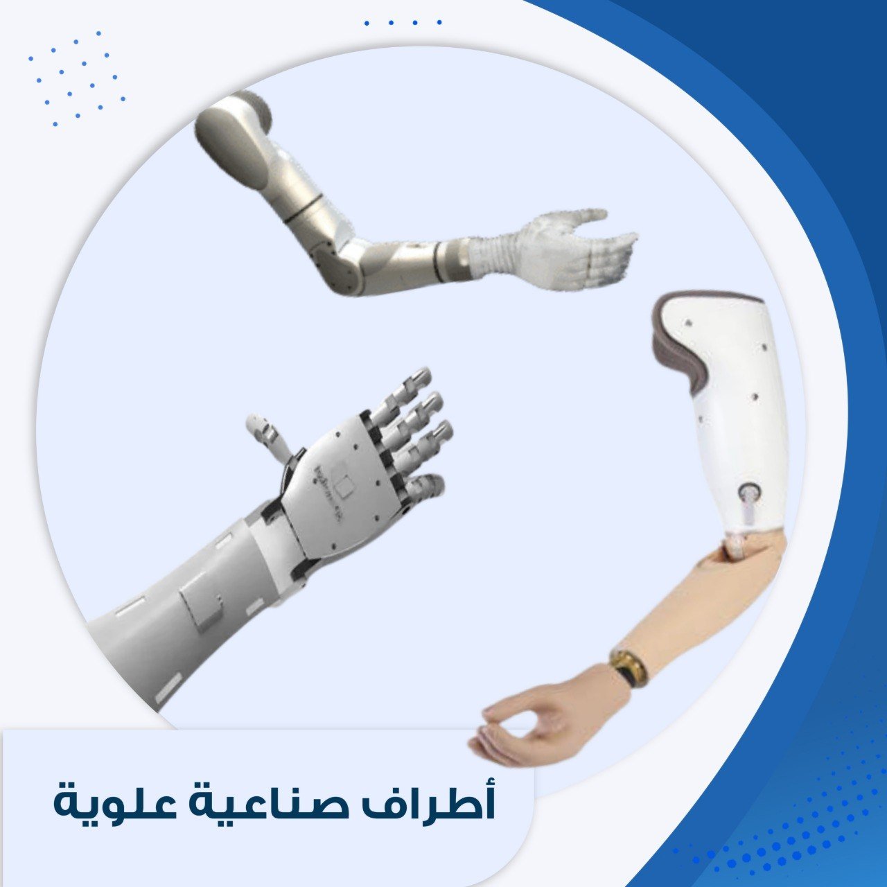 أطراف صناعية علوية