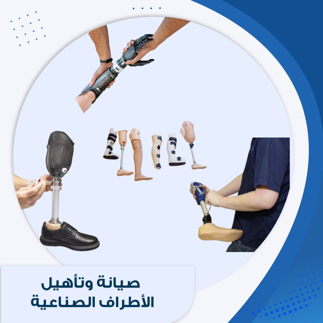 صيانة وتأهيل الأطراف الصناعية