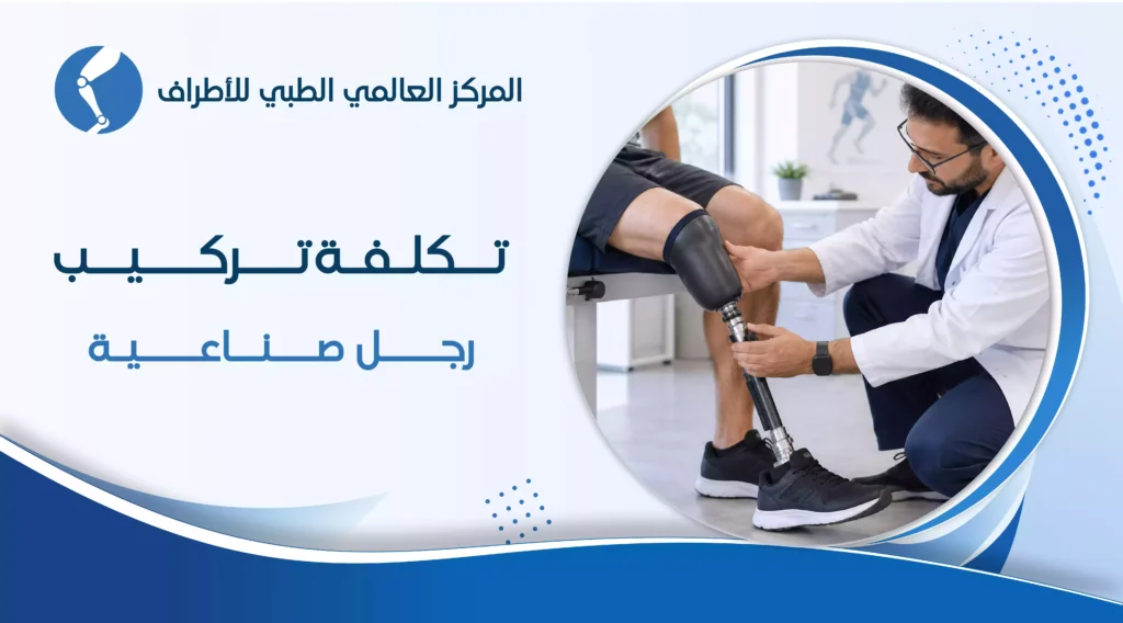 تكلفة تركيب رجل صناعية | الأسعار بالتفصيل