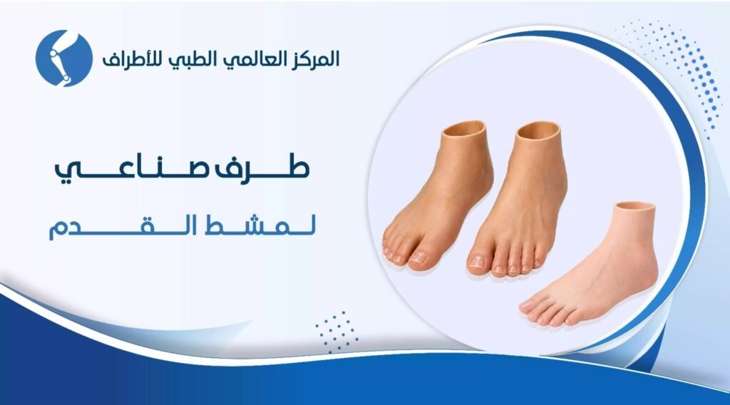 طرف صناعي لمشط القدم: الأنواع وأيهما أفضل؟
